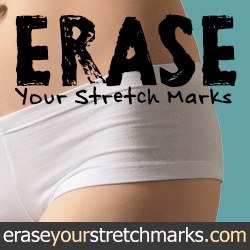 erase your strech marks